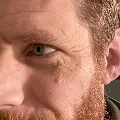 Mann sitt ansikt før The Solution