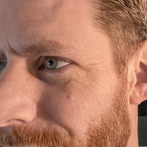 Mann sin hud etter The Solution