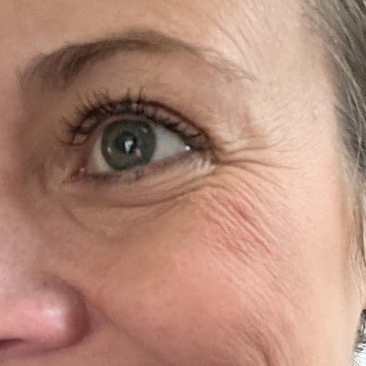 Ansiktet til Melissa før The Solution