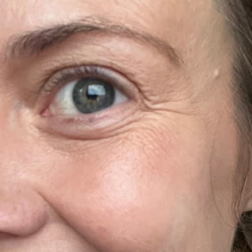 Ansiktet til Melissa etter The Solution