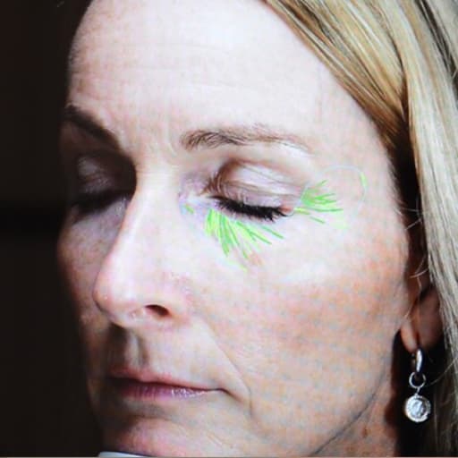 Rynker før The Solution