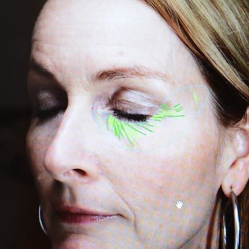 Rynker før The Solution