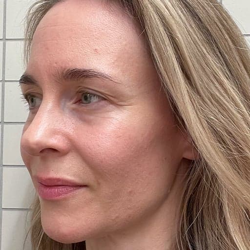 Bilde av Charlotte etter at hun har tatt The Solution